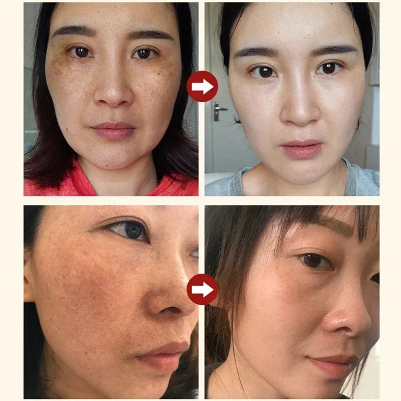 Powerful Dark Spots Remover Fr - Licorice Root Extract 评论和价格