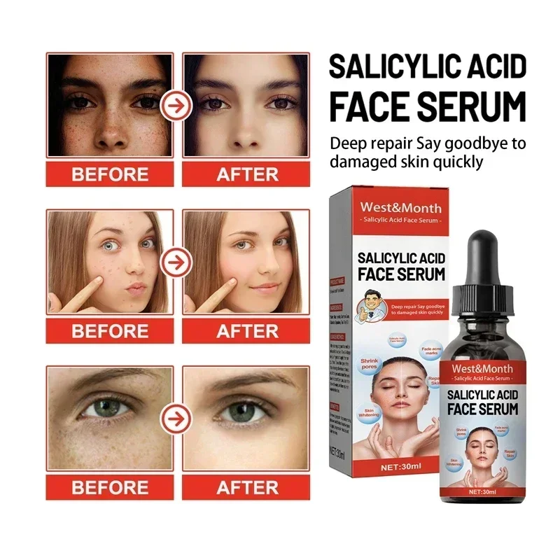 Powerful Dark Spots Remover Fr - Licorice Root Extract 评论和价格